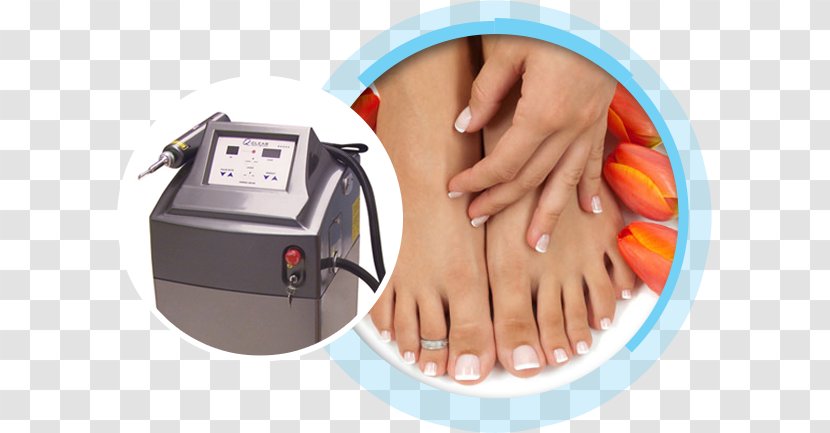 Toe Ring Foot Nail Onychomycosis - Flat Feet - Laser Treatment Transparent PNG