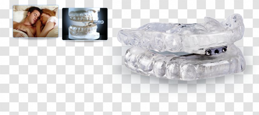 Snoring Dentistry Mandibular Advancement Splint Mouthguard - Sleep - Open An Account Freely Transparent PNG