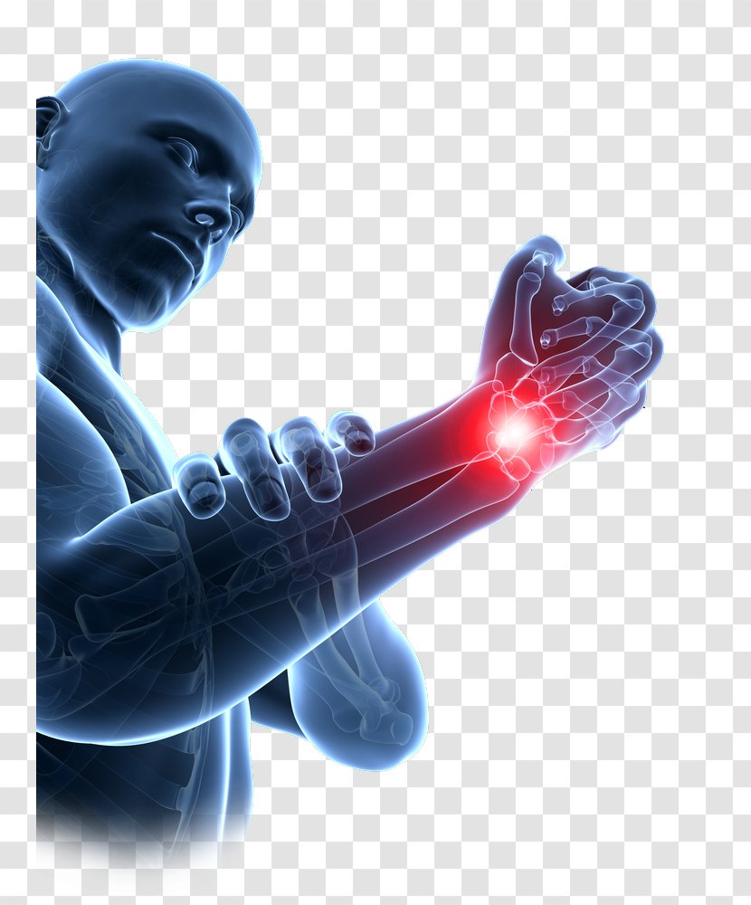 Repetitive Strain Injury Carpal Tunnel Syndrome Wrist Bones - Surgery - Hand Transparent PNG