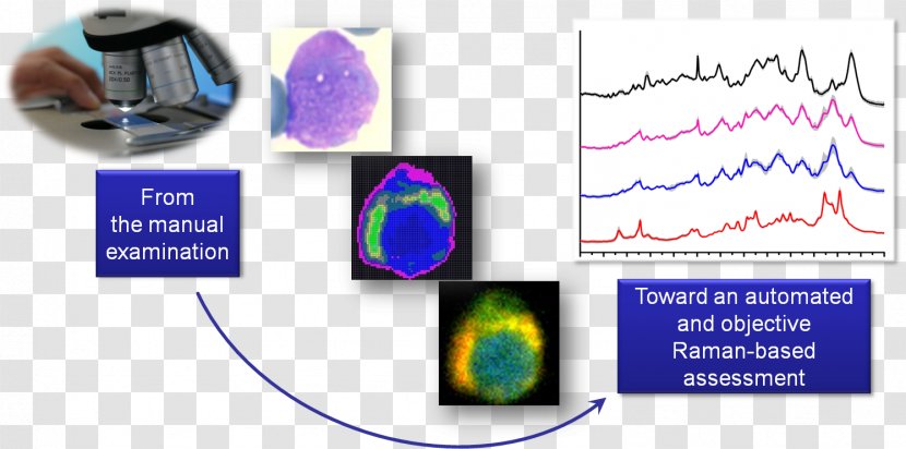 Surface-enhanced Raman Spectroscopy Cancer Cell - Acute Lymphoblastic Leukemia Transparent PNG