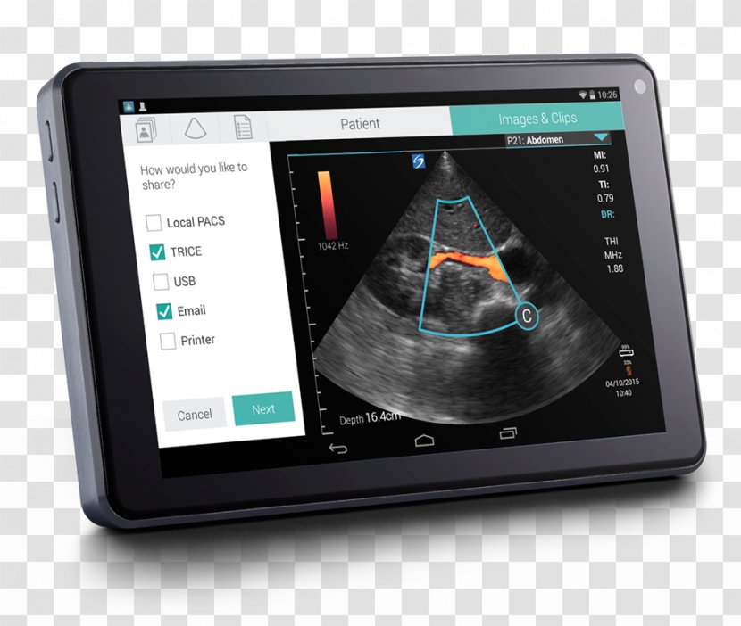 SonoSite, Inc. Ultrasonography Portable Ultrasound Fujifilm - Technology - Electronics Transparent PNG