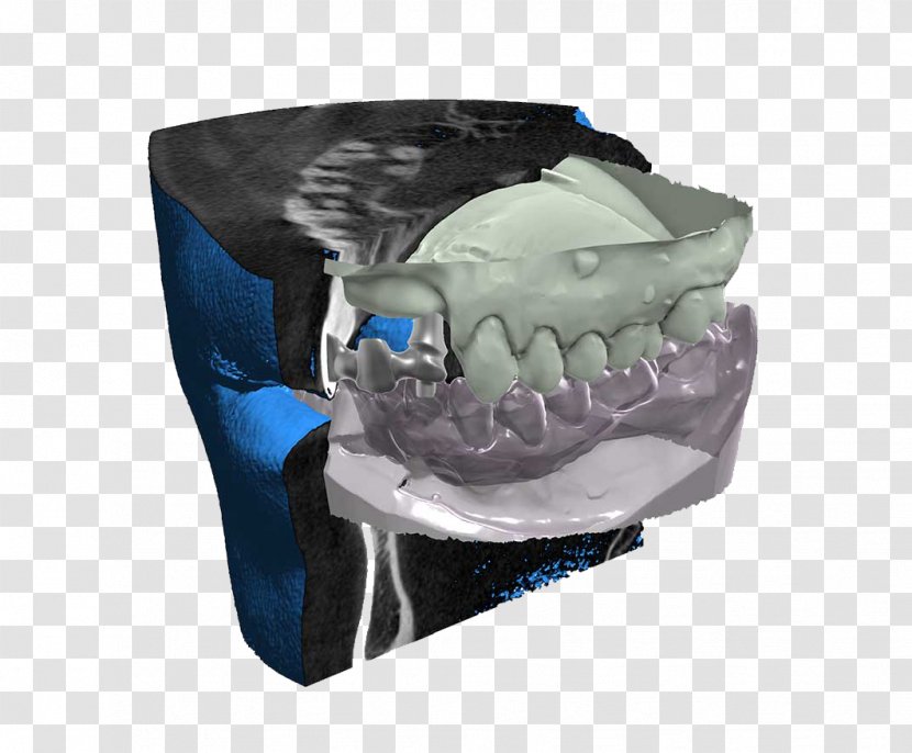 CAD/CAM Dentistry DICOM Computer Software Abutment Computer-aided Design - Computeraided - Dicom Transparent PNG