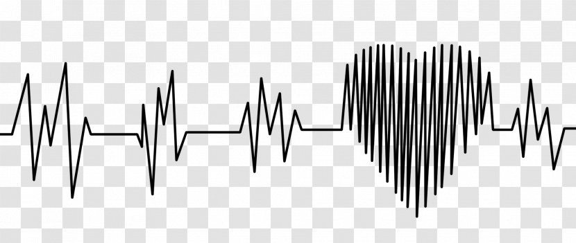 Electrocardiography Heart Rate Acute Myocardial Infarction Clip Art - Monochrome Photography Transparent PNG