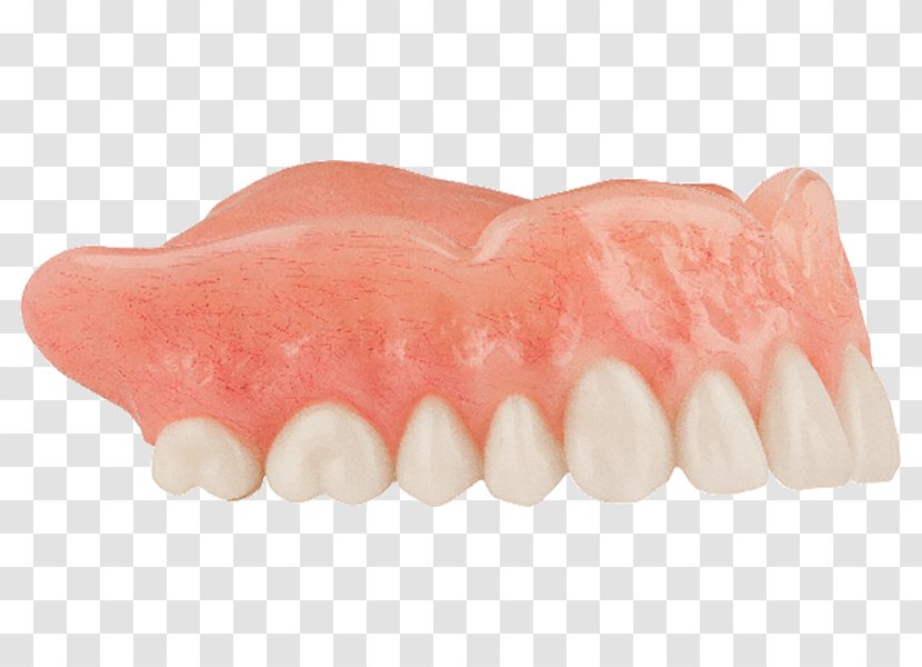 Human Tooth Dentures - Denture Transparent PNG