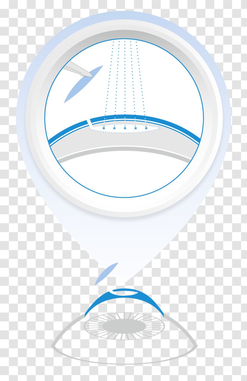 LASIK Cornea Laser Surgery Photorefractive Keratectomy ReLEx SMILE - Lasik Transparent PNG