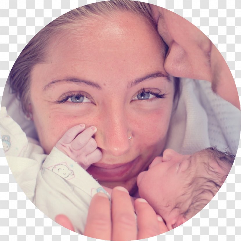 Caesarean Section Surgery Childbirth Anaesthesiologist Cheek - Skin - Prenatal Education Transparent PNG