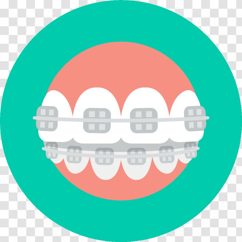 Dental Braces Dentistry Orthodontics Implant - Clear Aligners Transparent PNG
