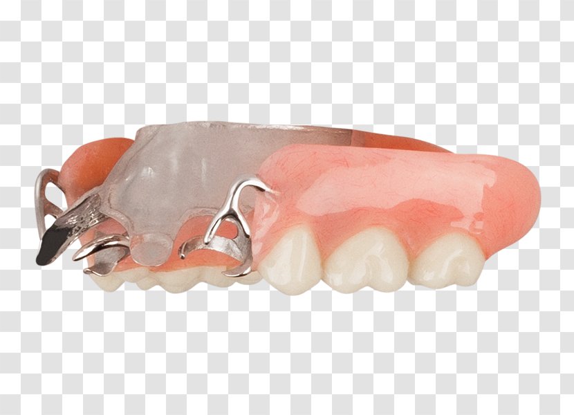 Dentistry Tooth Dentures Aspen Dental Evansville - Virginia Family Transparent PNG