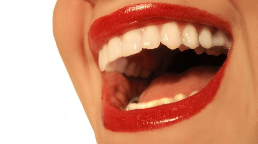 Cosmetic Dentistry Smile Tooth Whitening - Dental Bonding - Mouth Transparent PNG