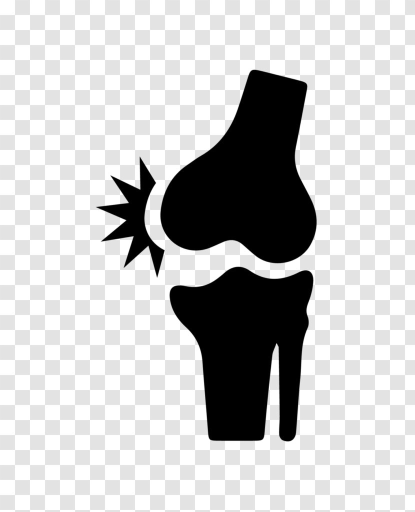 Joint Pain Bone Fracture Knee - Facet Transparent PNG