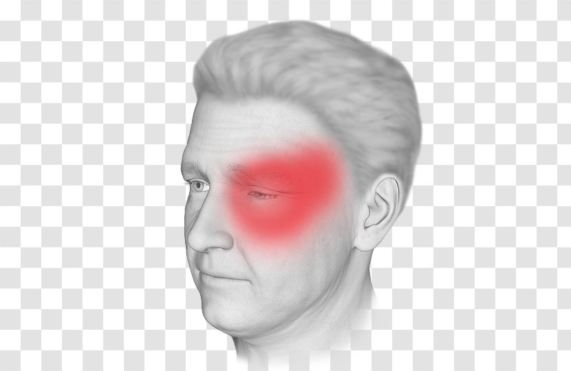 Cluster Headache Disease Nose - Drawing - Back Pain Transparent PNG