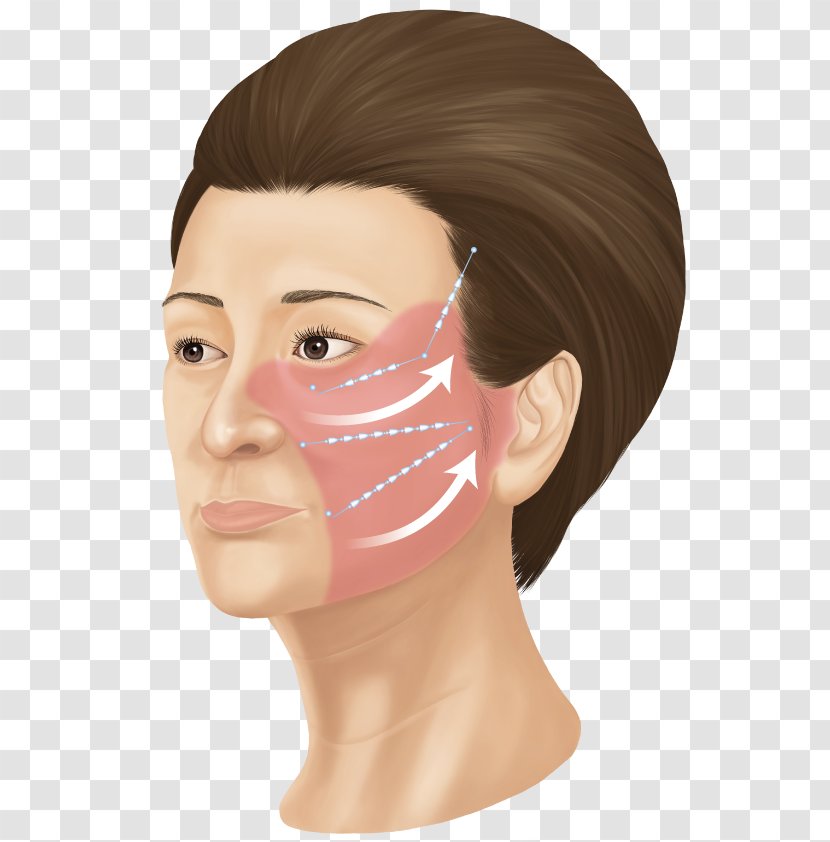 Cheek サフォクリニック Face Forehead 美容外科学 - Mouth Transparent PNG