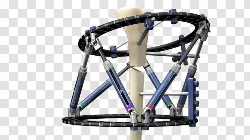 Response Ortho External Fixation Surgery Prosthesis Bone - Bicycle Fork - Ring Master Transparent PNG