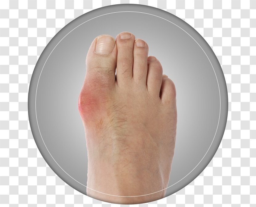 Thumb Bunion Toe Hallux Shoe Size - Silhouette - Gout Transparent PNG