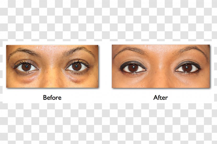 Dr. Amiya Prasad Eyelash Extensions Blepharoplasty Plastic Surgery - Watercolor - Eye Transparent PNG