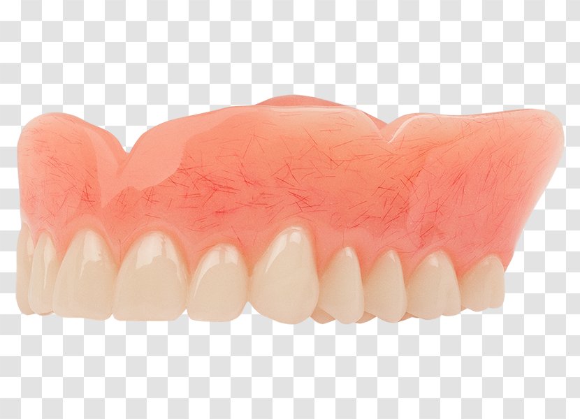 Tooth Dentistry Dentures Aspen Dental - Mouth - Denture Transparent PNG