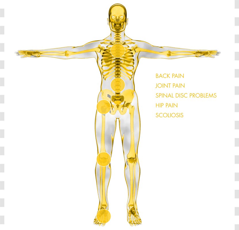 Muskuläre Dysbalance Shoulder Nerve Muscle Muscular System - Silhouette - Backpain Transparent PNG