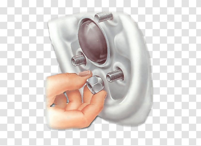 Hearing Medical Equipment - Off-road Car Illustration Transparent PNG