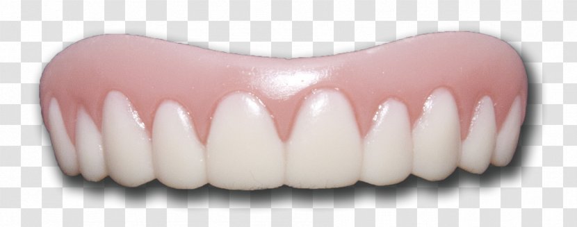 Veneer Tooth Whitening Dentures Pathology - Eyelash - Teeth Transparent Images Transparent PNG