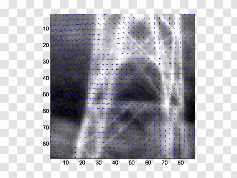 X-ray Radiology Lääketieteellinen Röntgenkuvaus Radiography Angle - Medical - Passive Infrared Sensor Transparent PNG