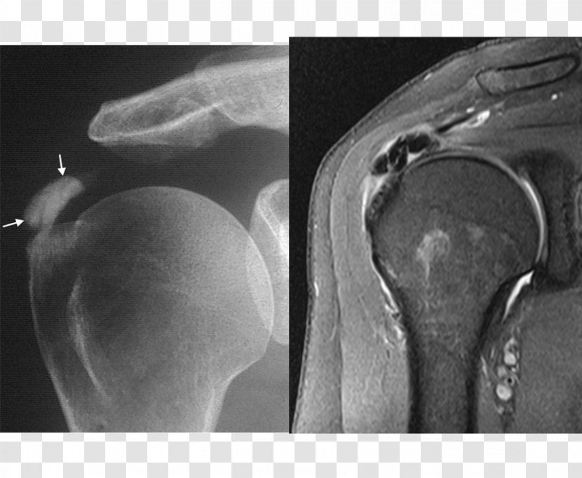 Medical Imaging Radiography Knee - Design Transparent PNG