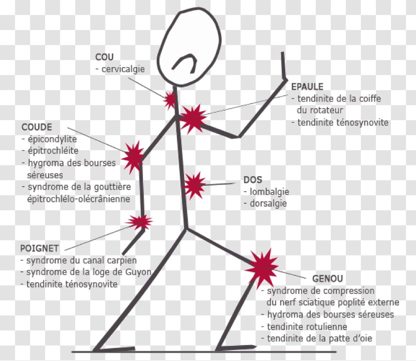 Repetitive Strain Injury Climat Social Empresa Labor Disease - Triangle - Sapa Transparent PNG