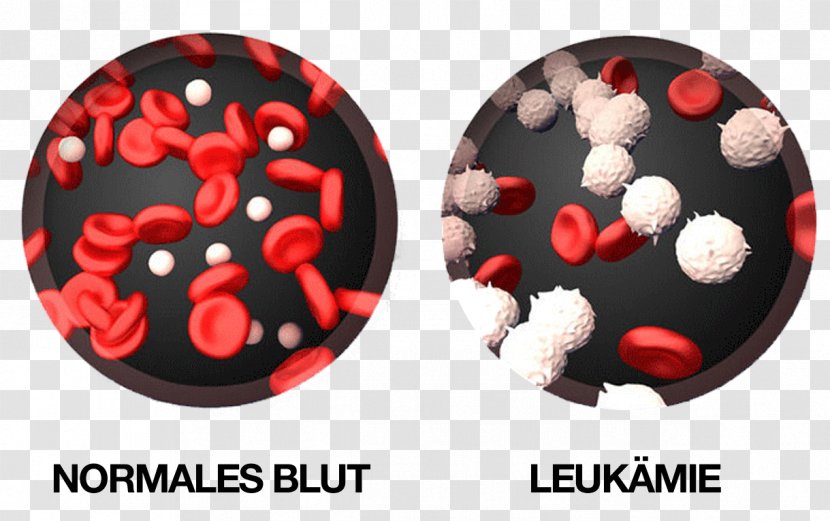 Chronic Myelogenous Leukemia White Blood Cell Transparent PNG