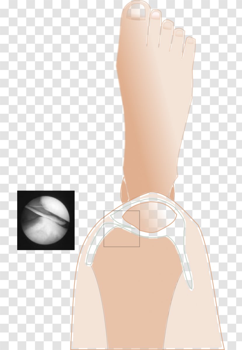 Thumb Plica Syndrome Knee Pain Patella - Flower - Get Elastic Transparent PNG