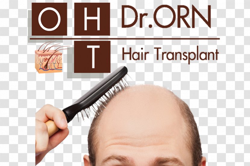 Management Of Hair Loss Transplantation Platelet-rich Plasma Therapy - Care Transparent PNG