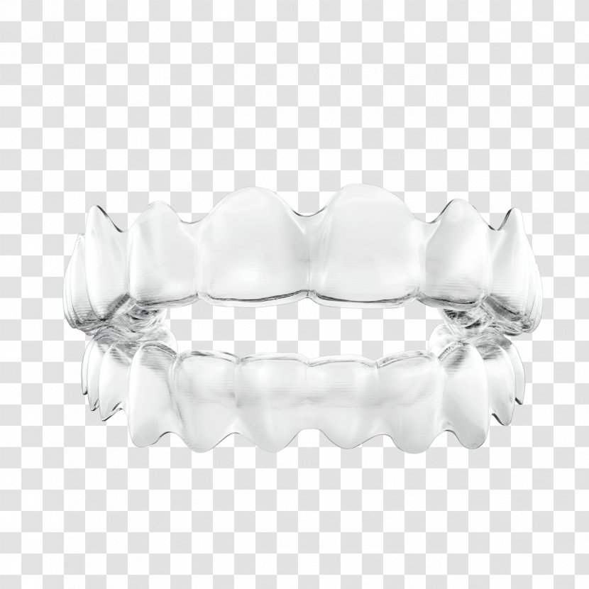 Clear Aligners Orthodontics Dental Braces Tooth Dentistry - Orthodontist - Creative Plans For Treatment Transparent PNG