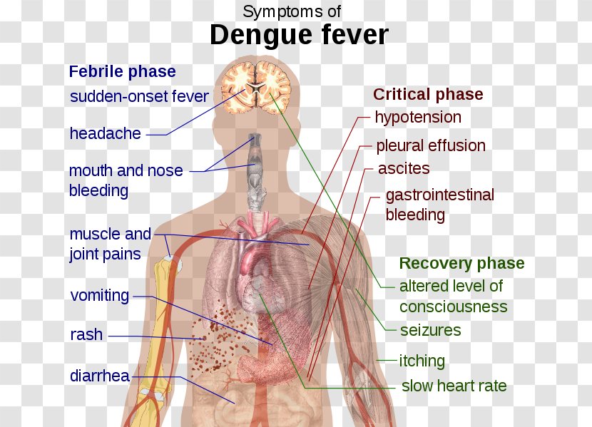 Dengue Symptomatic Treatment Fever Disease - Frame - Tree Transparent PNG