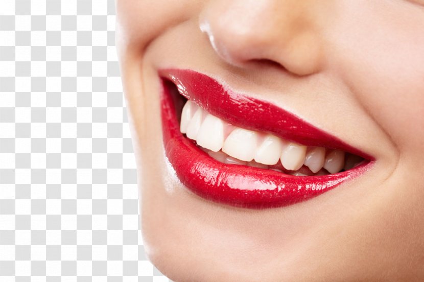 Bleach Tooth Decay Smile Dentistry - Cartoon - Teeth Model Transparent PNG