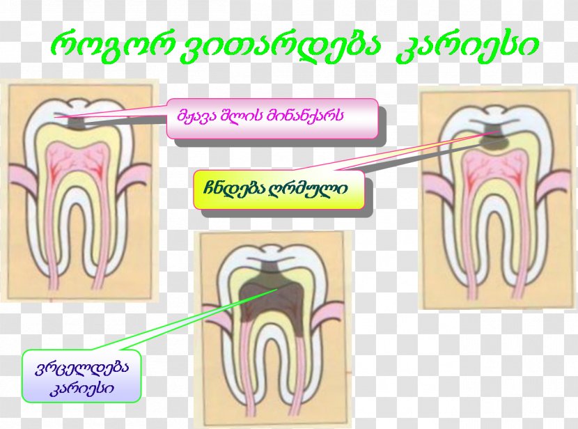 Tooth 0 AD 2 - Silhouette - Yn Transparent PNG