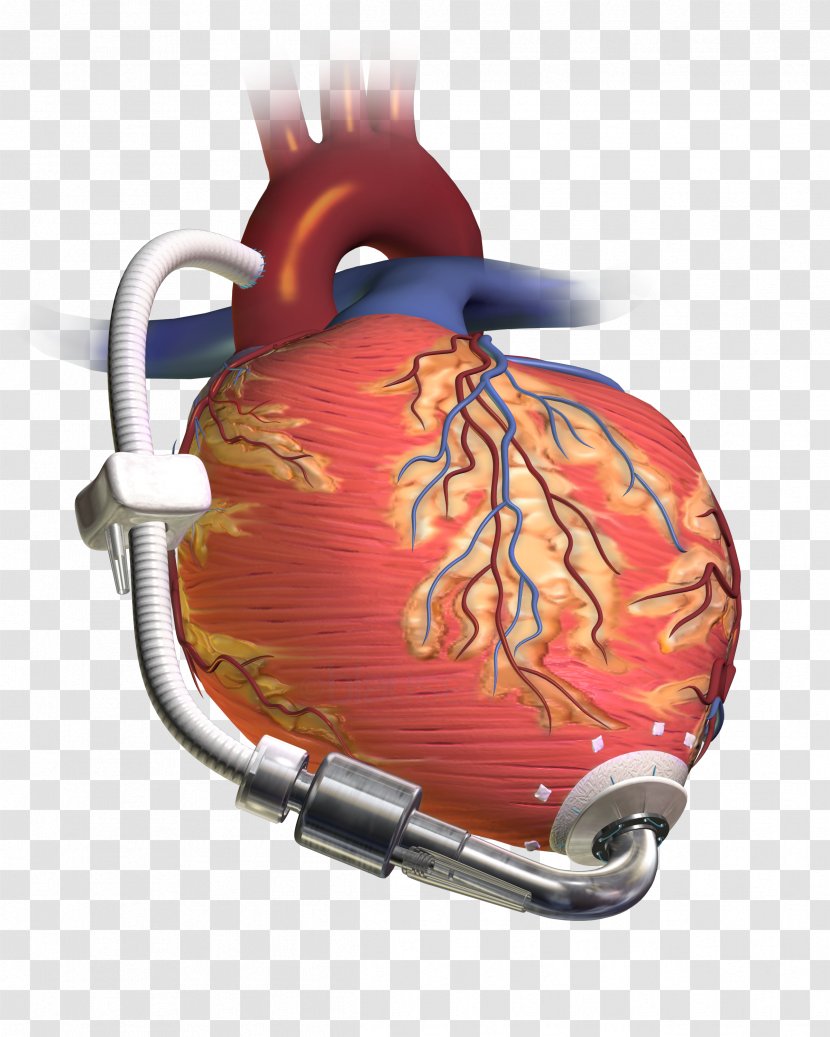 Ventricular Assist Device Heart Transplantation Artificial Ventricle - Frame - Left Transparent PNG