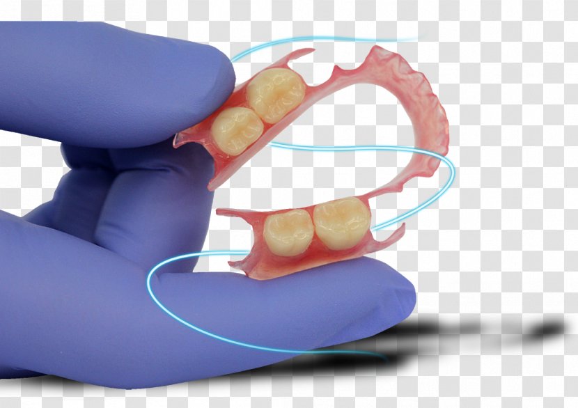 Dentures Prosthesis Dentistry Dental Laboratory - Tooth - Dentist Gum Shield Transparent PNG
