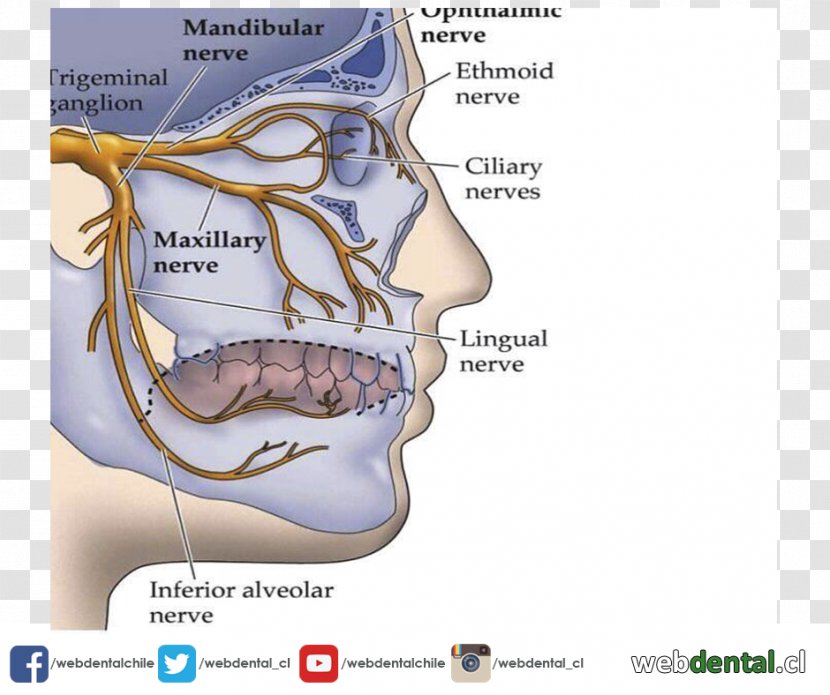 Tonsillectomy Ear Pain Tonsillolith Ache - Silhouette Transparent PNG