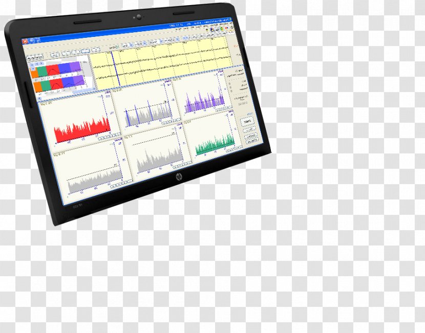 Neurofeedback Display Device Stress Neurofit Studio Attention Deficit Hyperactivity Disorder - Media - çim Transparent PNG