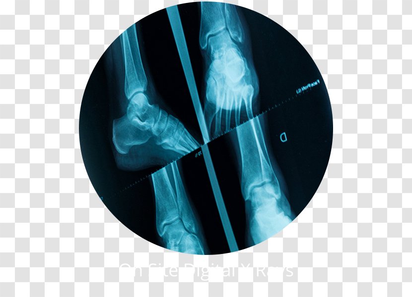 Sound Foot Care PC - Medical - Smithtown Podiatrist Commack X-ray Radiology HauppaugeOthers Transparent PNG