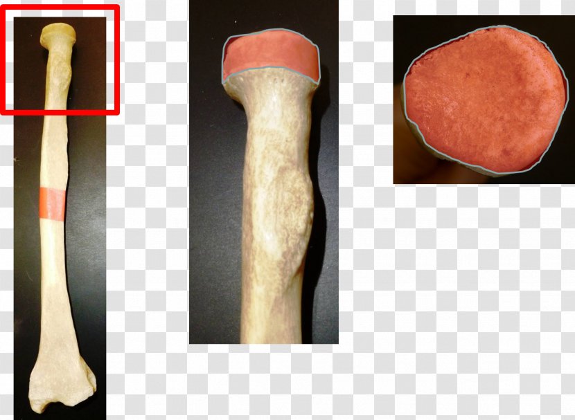 Head Of Radius Radial Fracture Tuberosity Bone - Proksimal - Arm Transparent PNG