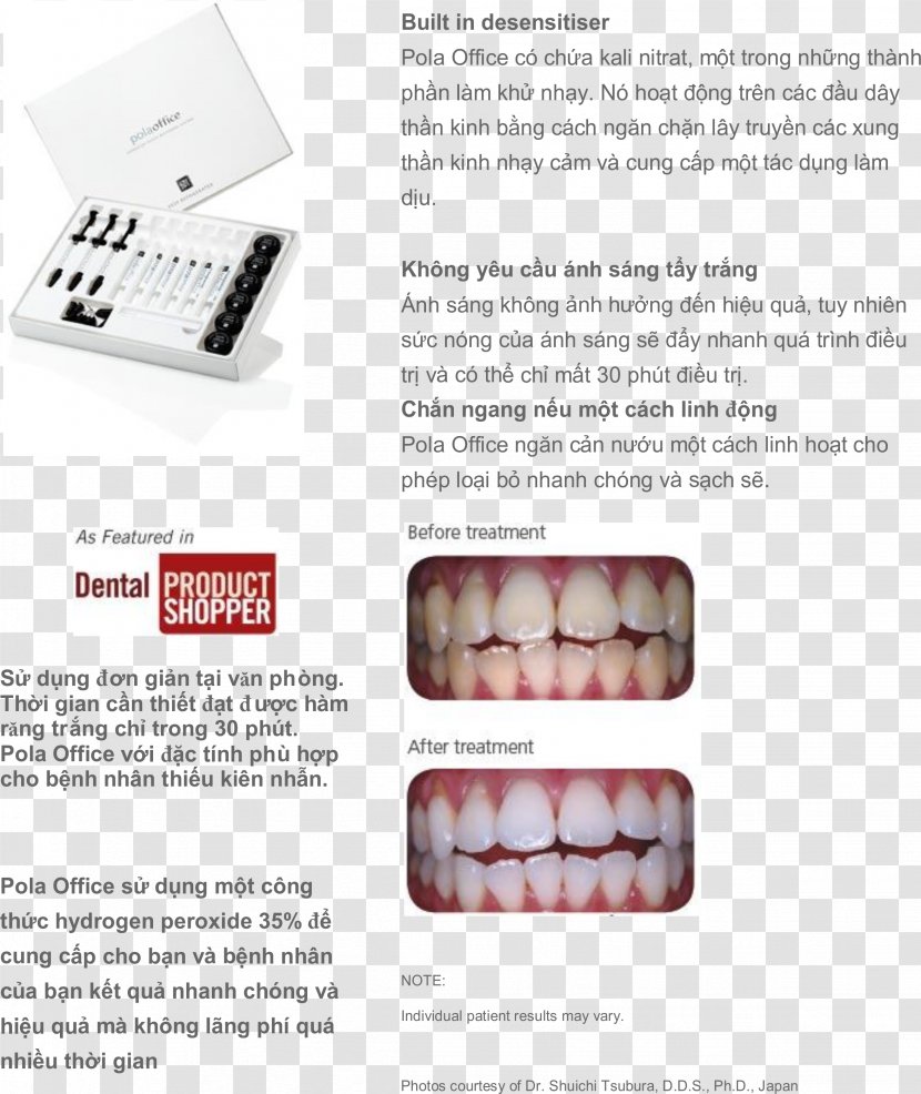McLennan Street Dental Clear Aligners Braces Tooth Dentist - Blog - Offive Transparent PNG