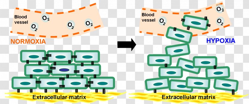 Hypoxia And Cancer: Biological Implications Therapeutic Opportunities Cancer Cell Tumor - Malignancy - A Study Article Transparent PNG