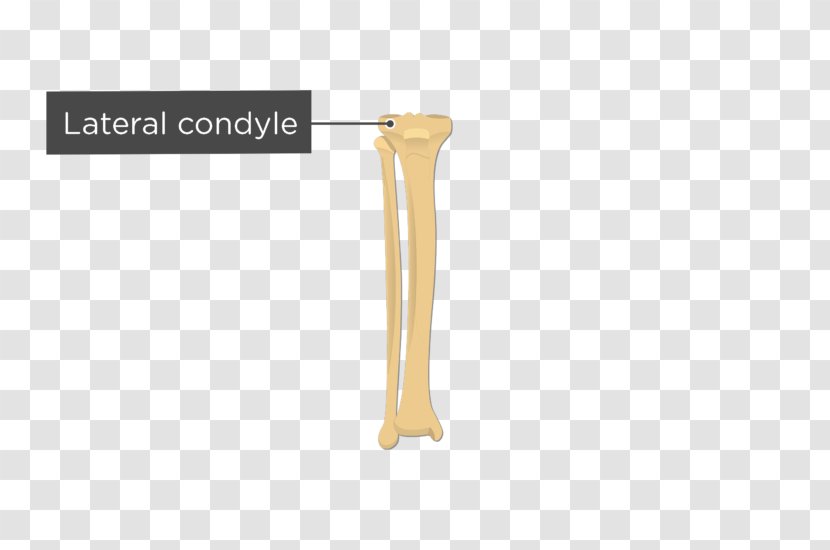 Lateral Condyle Of Tibia Fibula Medial Anatomy - Bone Fracture Transparent PNG