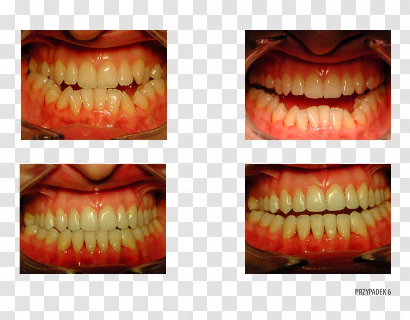 Close-up Tooth - Close Up - Jaw Transparent PNG