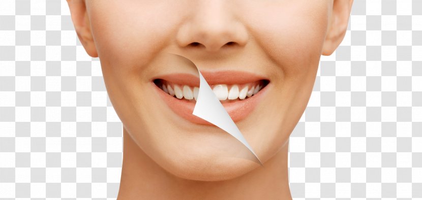 Tooth Whitening Dentistry Human Bleach - Smile Transparent PNG