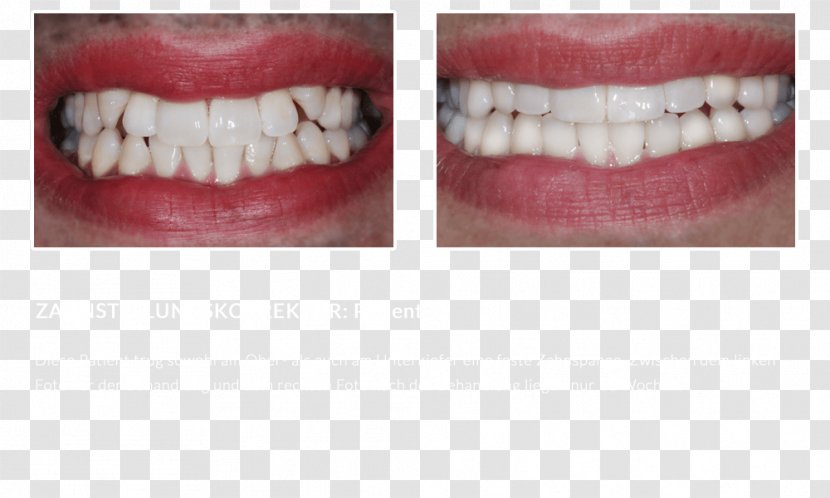 Tooth - Smile - Patient Transparent PNG