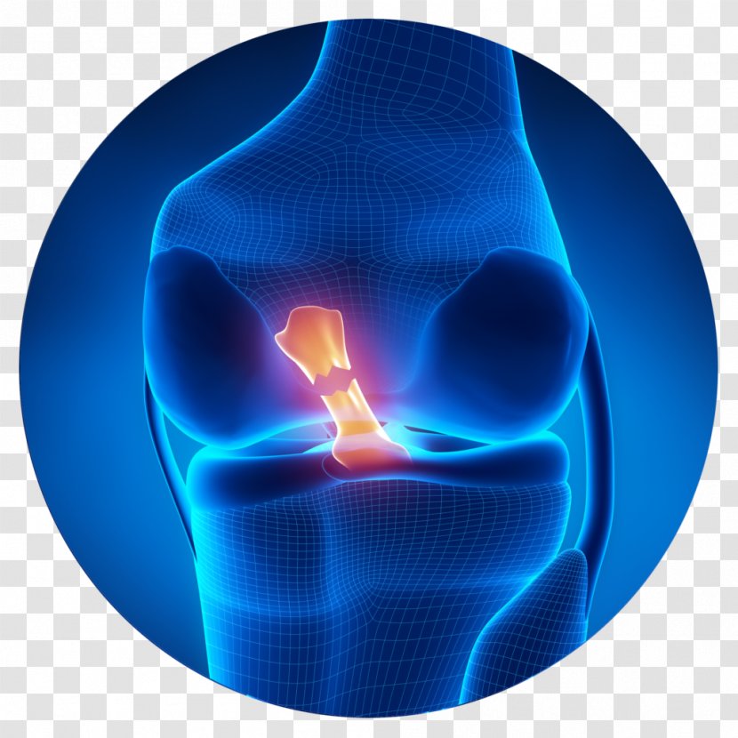 Anterior Cruciate Ligament Injury Medial Collateral Reconstruction - Physical Therapy Transparent PNG