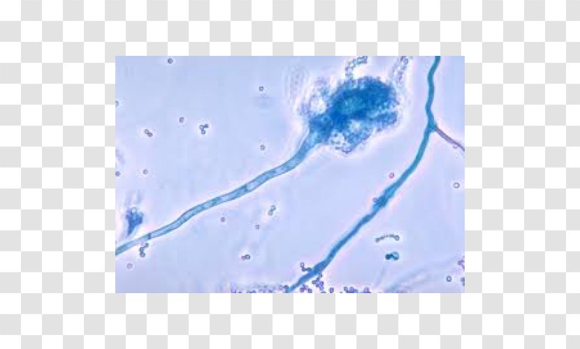 Aspergillus Fumigatus Aspergillosis Niger Fungus Aspergilloma - Mycotoxin Transparent PNG