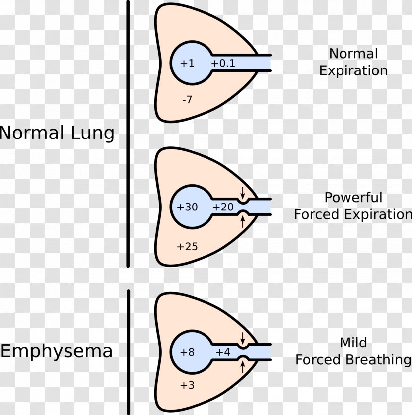 Dynamic Compression Of The Airways Lung Pulmonary Compliance Pursed Lip Breathing - Silhouette - Flower Transparent PNG