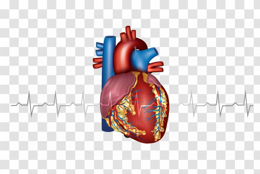 Myocardial Infarction Heart Cardiovascular Disease Artery - Tree - Creative Transparent PNG