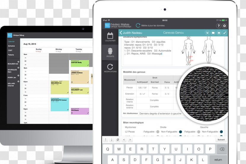 Netbook Computer Software Bug Tracking System Project Management - Ipad Transparent PNG